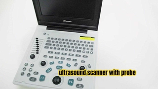 Équipement médical Saferlife Scanner à ultrasons